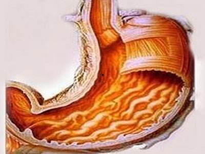 胃溃疡吃角瓜,天然食疗的养胃之道